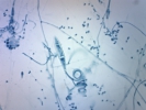 ترایکوفایتون منتاگروفاتیس - Trichophyton Mentagrophytes